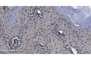 IHC analysis of CDK13 using anti-CDK13 antibody (ABIN7599667).