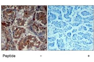 Image no. 2 for anti-Mechanistic Target of Rapamycin (serine/threonine Kinase) (mTOR) (Ser2448) antibody (ABIN319330) (MTOR Antikörper  (Ser2448))