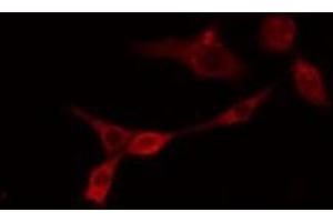 ABIN6275565 staining RAW264. (SHANK2 Antikörper  (Internal Region))
