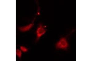 ABIN6274873 staining HepG2 cells by IF/ICC. (ATP5H Antikörper  (C-Term))