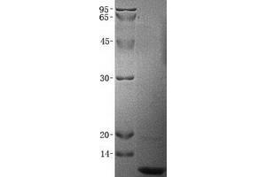 Validation with Western Blot (CXCL7 Protein)