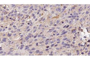 Immunohistochemistry (IHC) image for anti-ADAM Metallopeptidase with Thrombospondin Type 1 Motif, 13 (ADAMTS13) (C-Term) antibody (ABIN6259782)