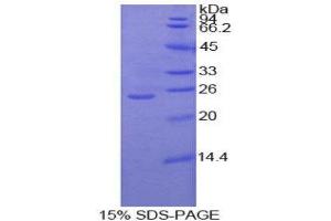 SDS-PAGE (SDS) image for Protein Kinase C, zeta (PRKCZ) (AA 404-591) protein (His tag) (ABIN2126505) (PKC zeta Protein (AA 404-591) (His tag))