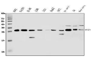 Western blot analysis of RanBP1 using anti-RanBP1 antibody (ABIN5518868). (RANBP1 Antikörper  (AA 2-201))