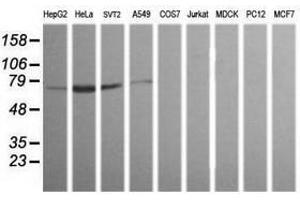 Image no. 1 for anti-ERG, ETS transcription factor (ERG) antibody (ABIN1498080) (ERG Antikörper)