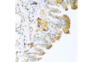 Immunohistochemistry of paraffin-embedded mouse lung using Vitronectin antibody (ABIN3022357, ABIN3022358, ABIN3022359 and ABIN6218758) at dilution of 1:100 (40x lens). (Vitronectin Antikörper  (AA 364-478))
