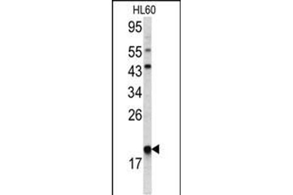 ARPC3 Antikörper  (C-Term)