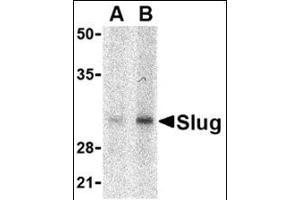 Western blot analysis of Slug in human kidney cell lysate with this product at in (A) 1 and (B) 2 μg/ml. (SLUG Antikörper  (Center))