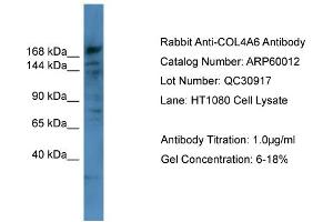 WB Suggested Anti-COL4A6  Antibody Titration: 0.