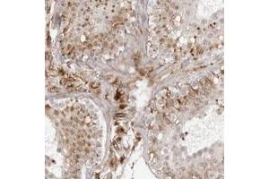 Immunohistochemical staining of human testis with TCTEX1D1 polyclonal antibody  shows cytoplasmic positivity in leydig and Sertoli cells at 1:500-1:1000 dilution. (TCTEX1D1 Antikörper)