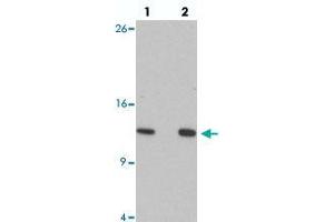 Western blot analysis of HIGD1A in 293 cell lysate with HIGD1A polyclonal antibody  at at (lane 1) 0. (HIGD1A Antikörper  (N-Term))
