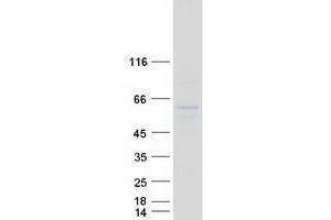 Western Blotting (WB) image for Inhibitor of Growth Family, Member 3 (ING3) (Transcript Variant 1) protein (Myc-DYKDDDDK Tag) (ABIN2723448)
