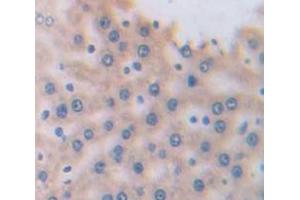 Figure. (A1BG Antikörper  (AA 313-513))