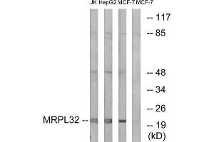 Western Blotting (WB) image for anti-Mitochondrial Ribosomal Protein L32 (MRPL32) (Internal Region) antibody (ABIN1850558) (MRPL32 Antikörper  (Internal Region))