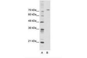 Image no. 1 for anti-Afamin (AFM) (AA 311-360) antibody (ABIN6736102)