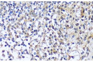 Immunohistochemistry of paraffin-embedded Human tonsil using A1CF Polyclonal Antibody at dilution of 1:100 (40x lens). (A1CF Antikörper)