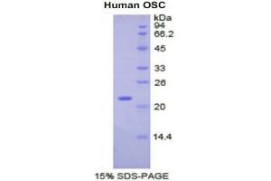 SDS-PAGE analysis of Human Oxidosqualene Cyclase Protein. (LSS Protein)