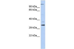 WB Suggested Anti-ARPC2 Antibody Titration: 0. (ARPC2 Antikörper  (N-Term))