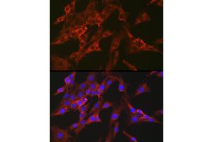 Immunofluorescence analysis of C6 cells using FBP1 Rabbit pAb (ABIN6130385, ABIN6140501, ABIN6140502 and ABIN6221054) at dilution of 1:100 (40x lens). (FBP1 Antikörper  (AA 1-338))