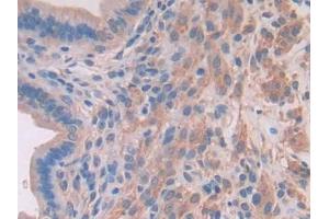 DAB staining on IHC-P; Samples: Mouse Uterus Tissue (MYLK2 Antikörper  (AA 330-548))