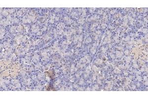 Detection of TF in Human Pancreas Tissue using Monoclonal Antibody to Tissue Factor (TF) (Tissue factor Antikörper  (AA 34-251))