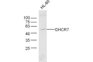 Human HL-60 cell lysates probed with Anti-DHCR7 Polyclonal Antibody, Unconjugated  at 1:300 overnight at 4˚C. (DHCR7 Antikörper  (AA 351-450))