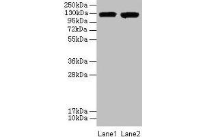 Western blot All lanes: ITGAL antibody at 8 μg/mL Lane 1: A549 whole cell lysate Lane 2: HepG2 whole cell lysate Secondary Goat polyclonal to rabbit IgG at 1/10000 dilution Predicted band size: 129, 135, 120 kDa Observed band size: 129 kDa (ITGAL Antikörper  (AA 201-500))