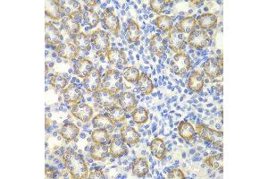 Immunohistochemistry (IHC) image for anti-Synaptotagmin I (SYT1) (AA 1-422) antibody (ABIN3021250)