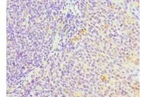 Immunohistochemistry of paraffin-embedded human tonsil tissue using ABIN7169354 at dilution of 1:100 (SERPINH1 Antikörper  (AA 139-418))