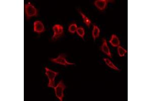 ABIN6272316 staining HeLa by IF/ICC. (HABP2 Antikörper  (Internal Region))