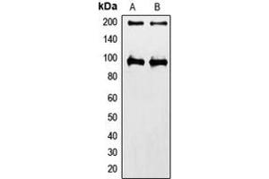 Western blot analysis of IGF1 Receptor expression in HeLa (A), MCF7 (B) whole cell lysates. (IGF1R Antikörper  (C-Term))