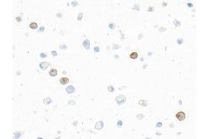 Immunocytochemistry (ICC) image for anti-Interleukin 9 (IL9) (AA 19-144) antibody (ABIN7795753)