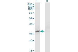 Western Blot analysis of CRYBB3 expression in transfected 293T cell line by CRYBB3 monoclonal antibody (M01), clone 4H6. (CRYBB3 Antikörper  (AA 112-211))