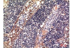 Immunohistochemistry (IHC) analysis of paraffin-embedded Human Lymph, antibody was diluted at 1:100. (ADAM10 Antikörper)
