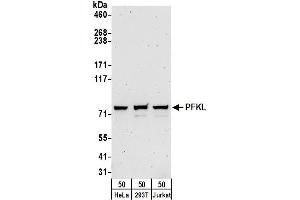 Western Blotting (WB) image for anti-Phosphofructokinase, Liver (PFKL) (AA 1-50) antibody (ABIN7449786)