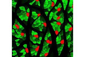 Immunofluorescent analysis of paraformaldehyde-fixed rat skeletal muscle using MYH1 (, red ) and MYH7 (ABIN7075623, green ) at dilution of 1: 1000 (Slow Skeletal Myosin Heavy Chain Antikörper)