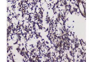 IHC analysis of GRIK1 using anti-GRIK1 antibody (ABIN3042430).
