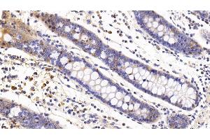 Detection of IL6 in Human Colon Tissue using Monoclonal Antibody to Interleukin 6 (IL6) (IL-6 Antikörper  (AA 29-212))