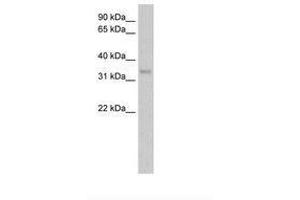 Image no. 1 for anti-Carbonic Anhydrase IV (CA4) (AA 131-180) antibody (ABIN204967) (CA4 Antikörper  (AA 131-180))