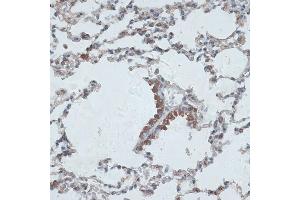Immunohistochemistry of paraffin-embedded mouse lung using PMEP antibody (6555) at dilution of 1:100 (40x lens). (PMEPA1 Antikörper  (AA 173-252))