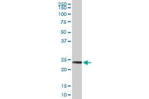 MAGEA8 MaxPab rabbit polyclonal antibody. (MAGEA8 Antikörper  (AA 1-318))