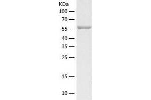 Western Blotting (WB) image for Cadherin 11 (CDH11) (AA 54-617) protein (His tag) (ABIN7122070) (OB Cadherin Protein (AA 54-617) (His tag))