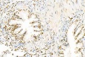 Immunohistochemistry (Paraffin-embedded Sections) (IHC (p)) image for anti-Pinin, Desmosome Associated Protein (PNN) antibody (ABIN7075083)