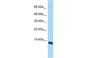 Host: Rabbit Target Name: MIR22HG Sample Type: Fetal Brain lysates Antibody Dilution: 1. (MIR22HG Antikörper  (C-Term))