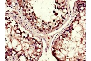 Immunohistochemistry of paraffin-embedded human testis tissue using ABIN7149312 at dilution of 1:100 (DYNC1H1 Antikörper  (AA 12-66))