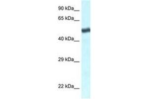 Image no. 1 for anti-Transducin (Beta)-Like 1 X-Linked Receptor 1 (TBL1XR1) (C-Term) antibody (ABIN6747500) (TBL1XR1 Antikörper  (C-Term))