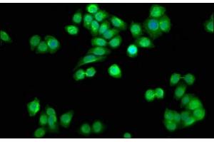 Immunofluorescence staining of PC-3 cells with ABIN7168295 at 1:33, counter-stained with DAPI. (SSU72 Antikörper  (C-Term))