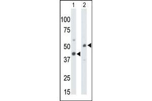 The anti-CKMT1 Pab (ABIN391091 and ABIN2841231) is used in Western blot to detect CKMT1 in mouse colon tissue lysate (Lane 1) and ZR-75-1 cell lysate (Lane 2). (CKMT1 Antikörper  (N-Term))