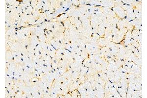 ABIN6258867 and ABIN6275388 at 1/100 staining Mouse heart tissue by IHC-P.