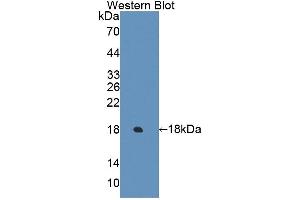 Detection of Recombinant ECRG4, Human using Polyclonal Antibody to Esophageal Cancer Related Gene 4 (ECRG4) (Esophageal Cancer Related Gene 4 (AA 32-148) Antikörper)